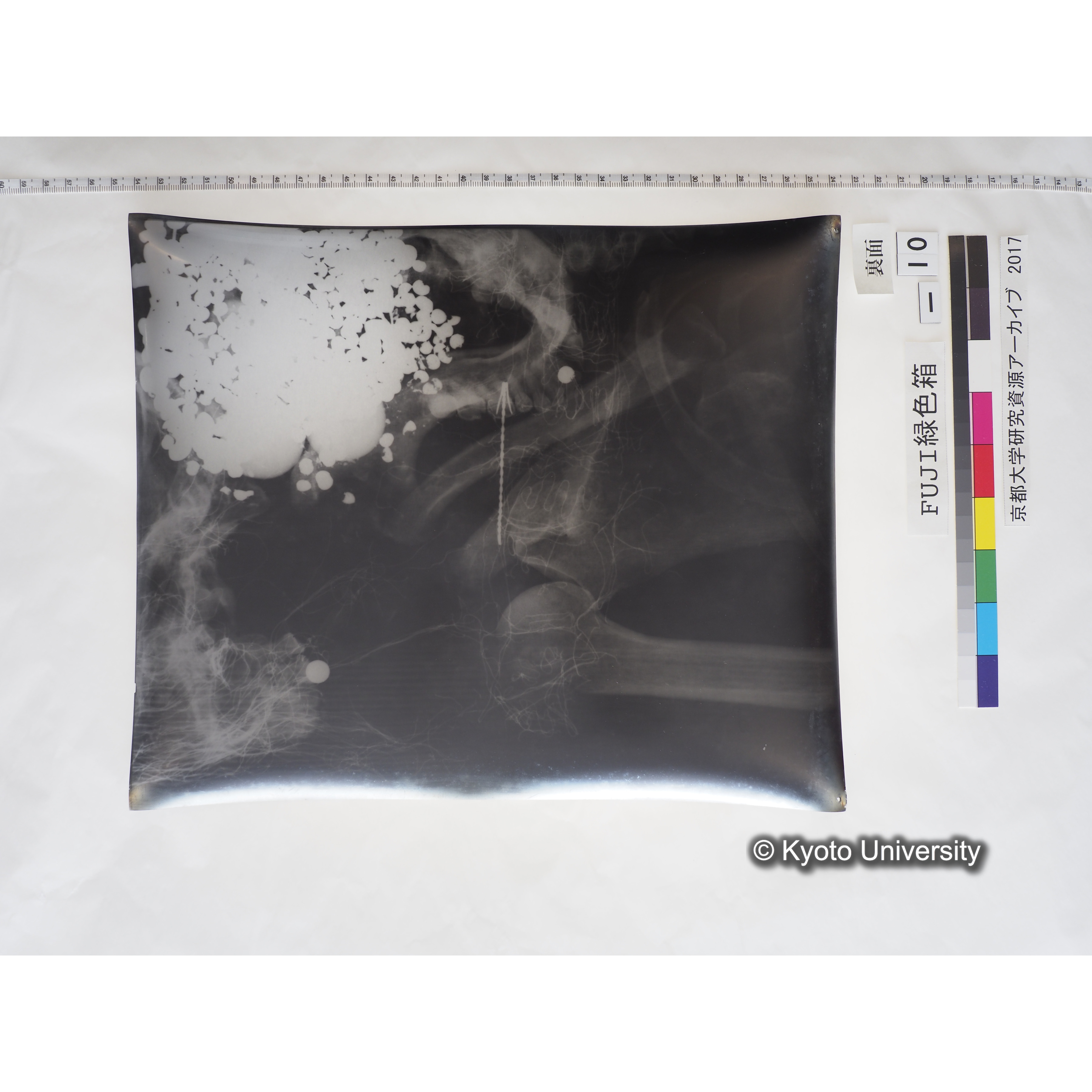 [フィルム] 顎部から胸部レントゲン (2)