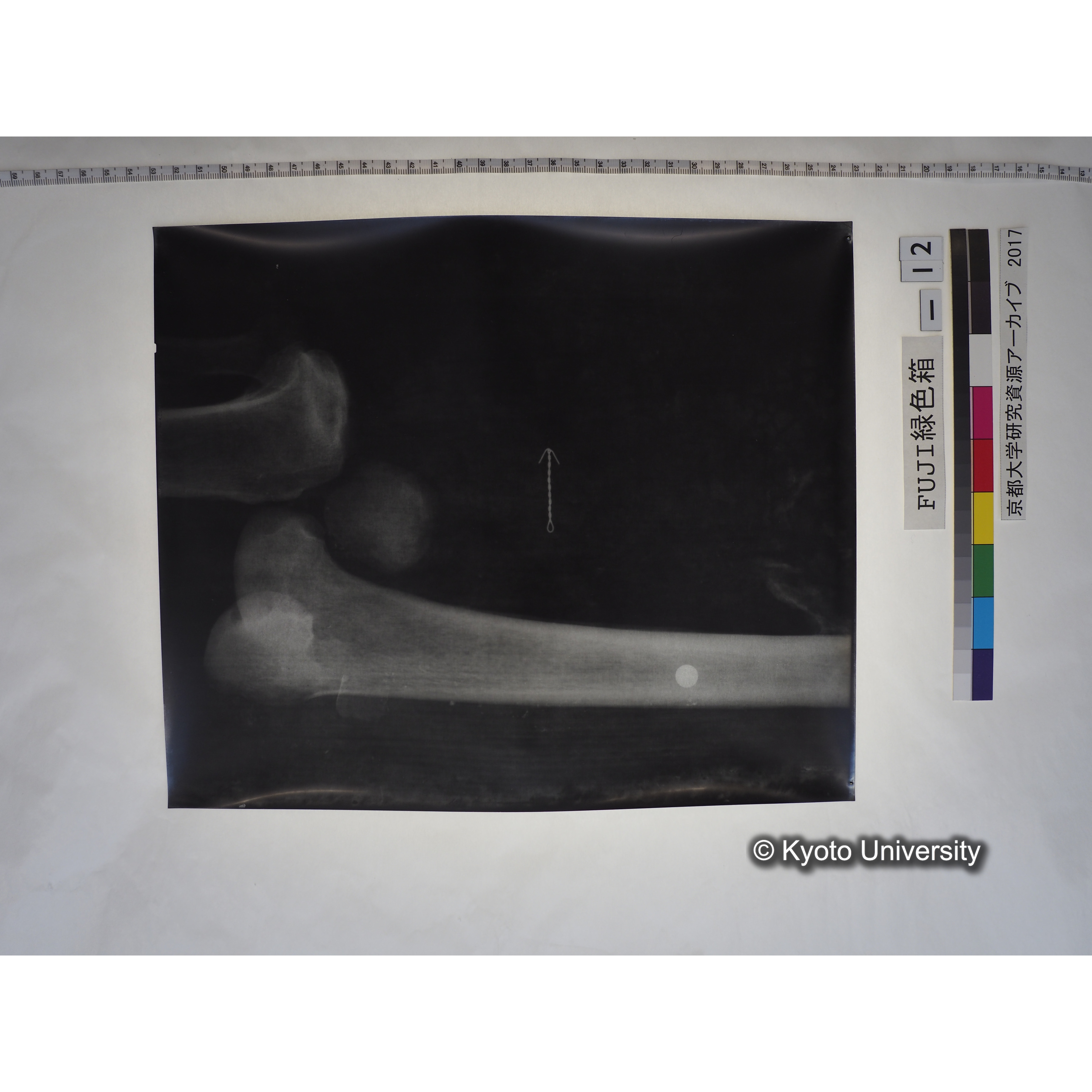 [フィルム] 足部レントゲン (1)