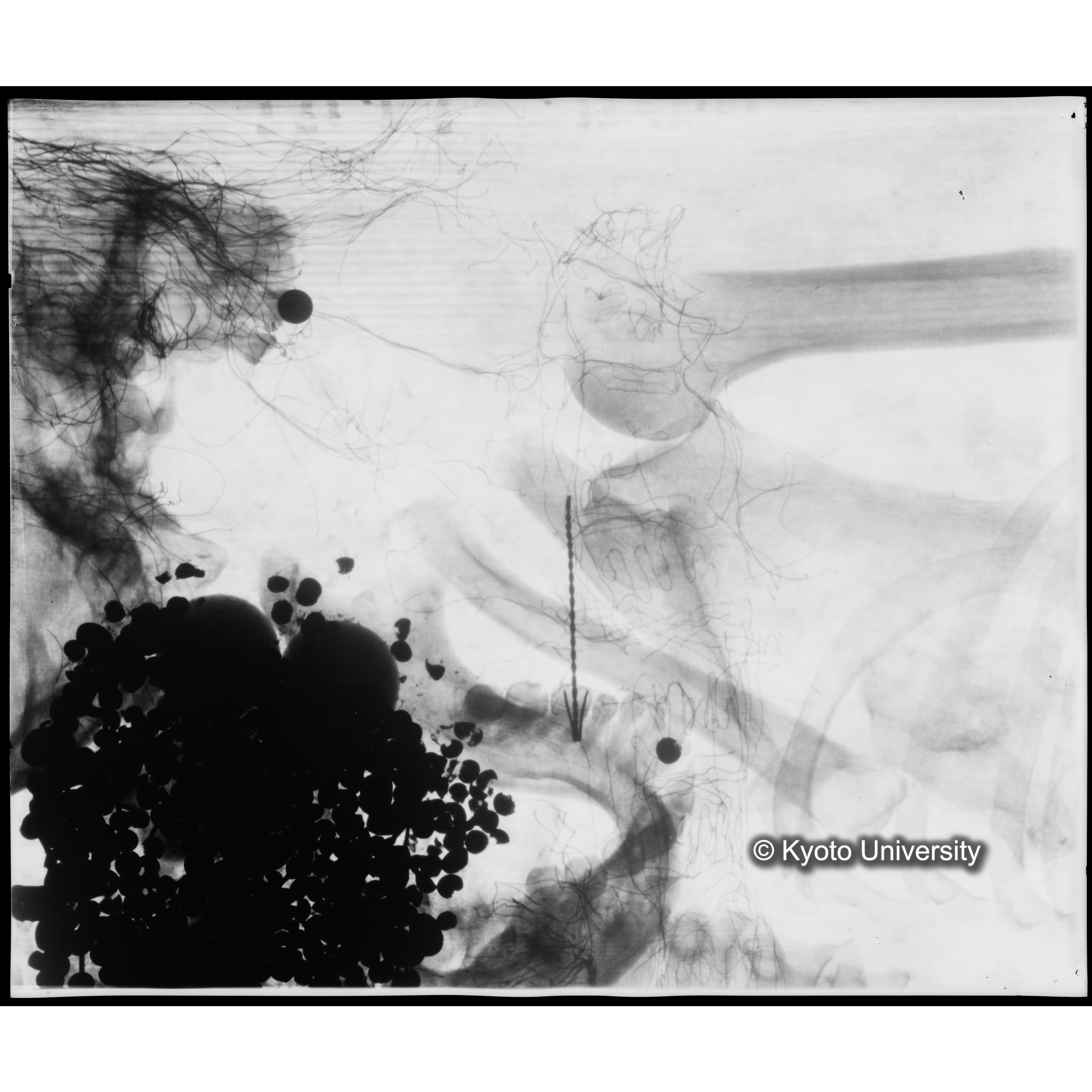 [写真内容] 顎部から胸部レントゲン (1)