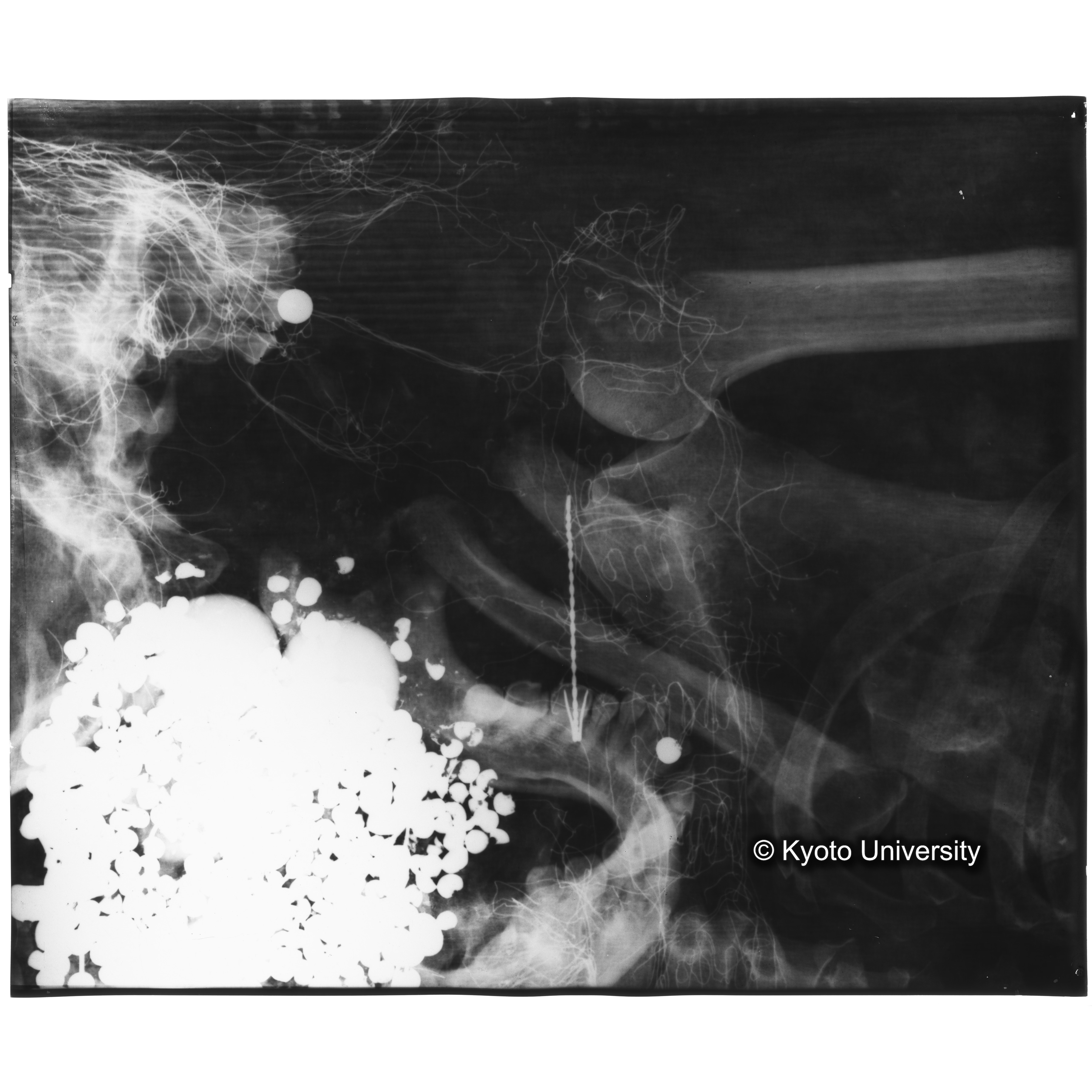 [写真内容] 顎部から胸部レントゲン (3)