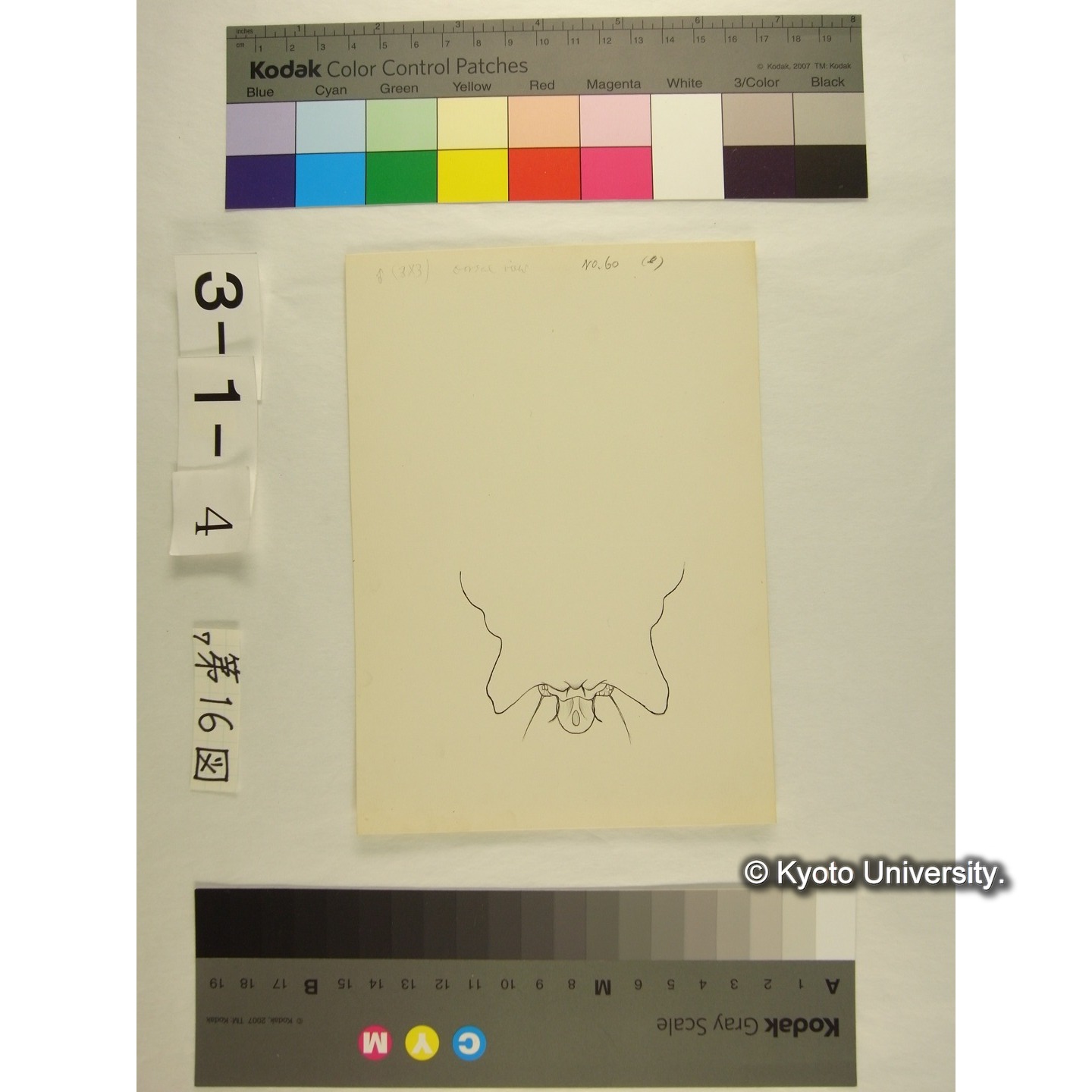 第16図 (ヨロイミズダニか) (5)