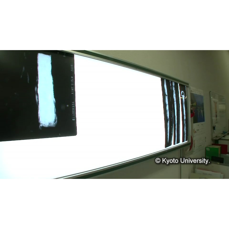 X線透過試験 (1)