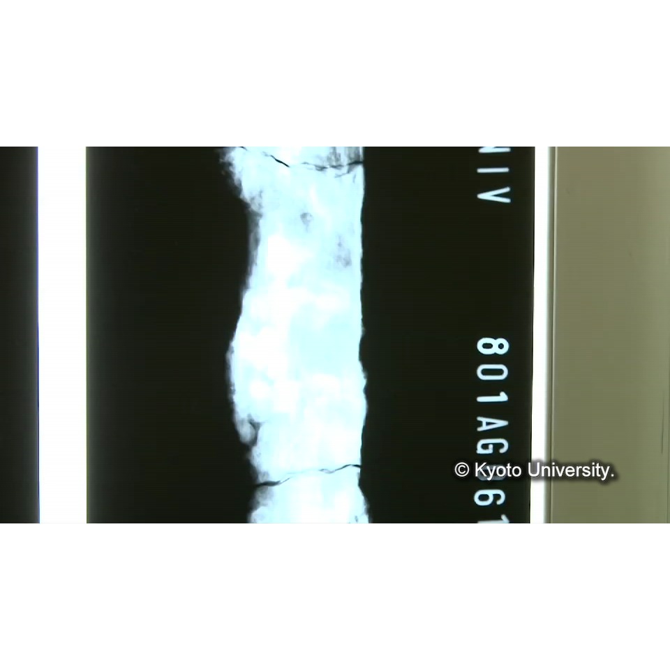 X線透過試験 (1)