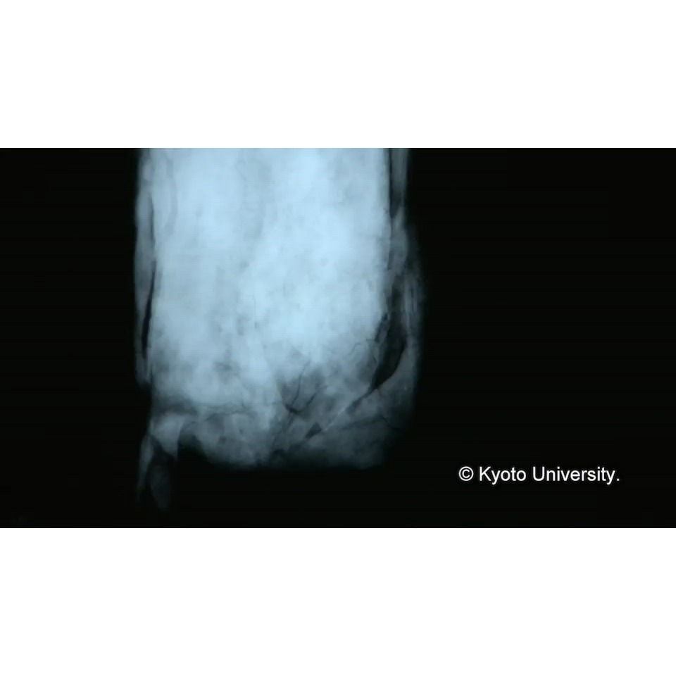 X線透過試験 (1)