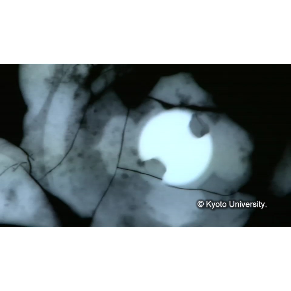 X線透過試験 (1)