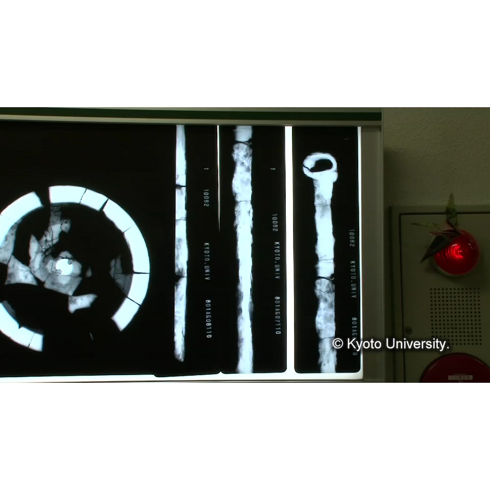 X線透過試験 (1)