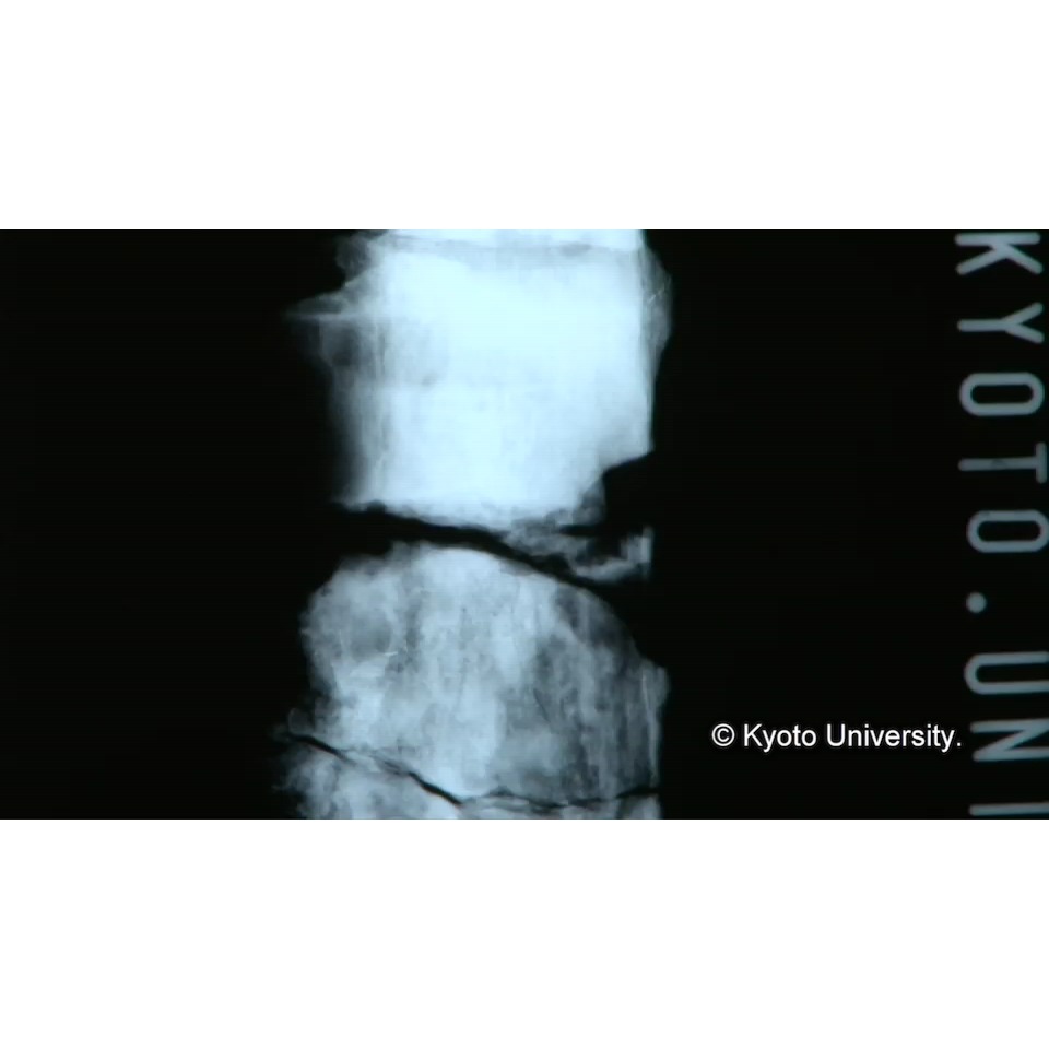 X線透過試験 (1)