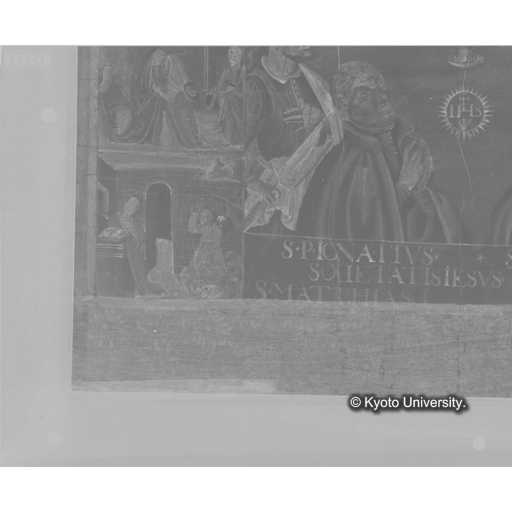 Ｘ線透過写真（六分割：左側下段） (1)