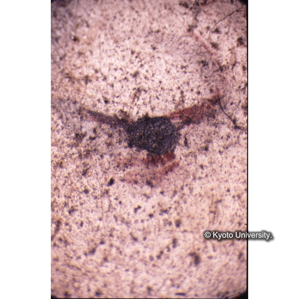 顕微鏡撮影カラー写真（十五玄義第十五図：マリア目） (1)