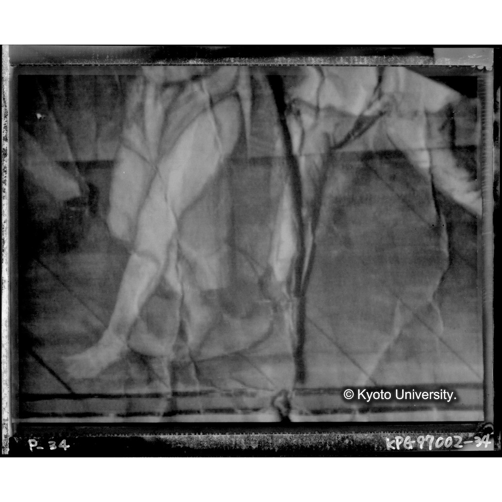 赤外線テレビ撮影画像写真（十五玄義第七図） (1)