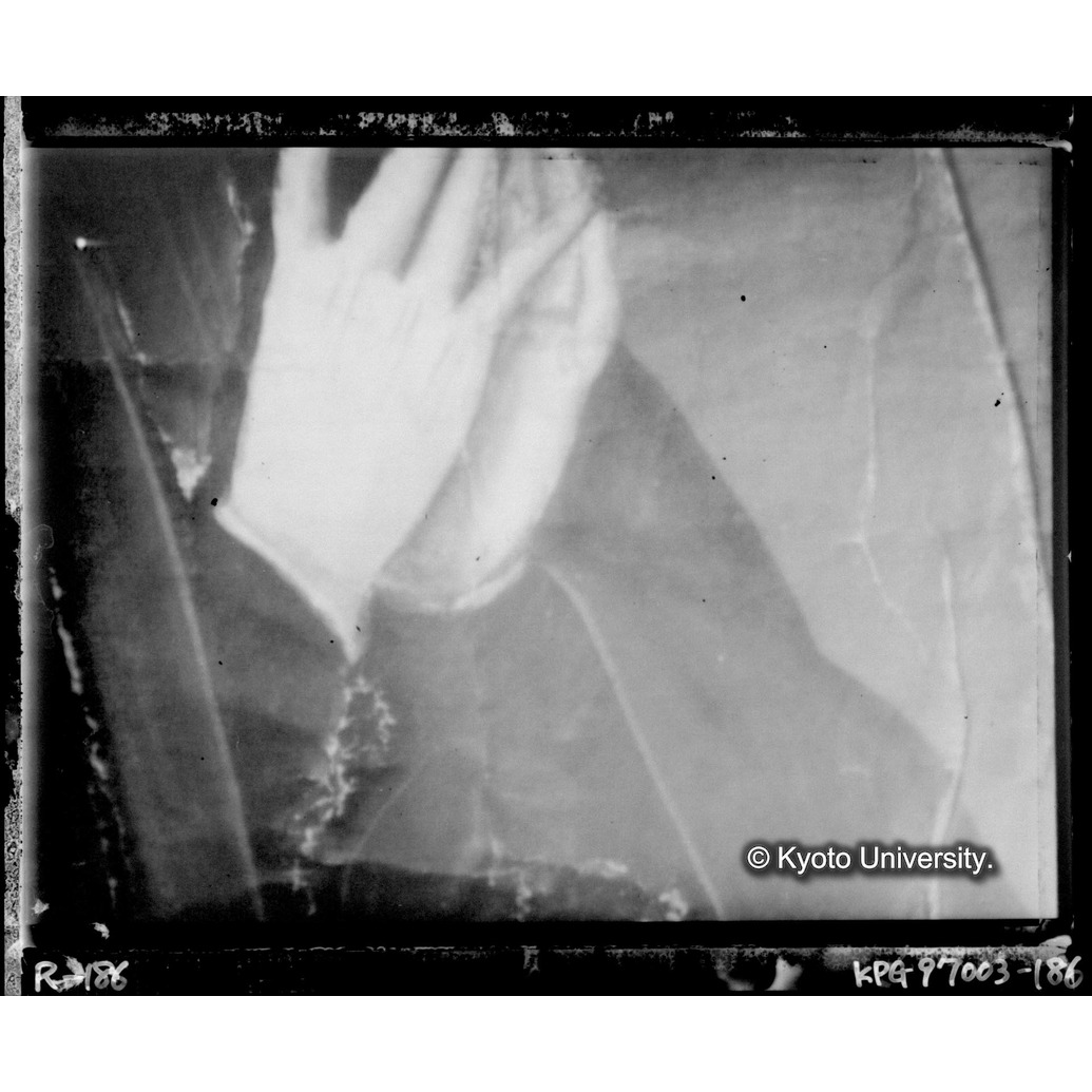 赤外線テレビ撮影画像写真（中央下段） (1)