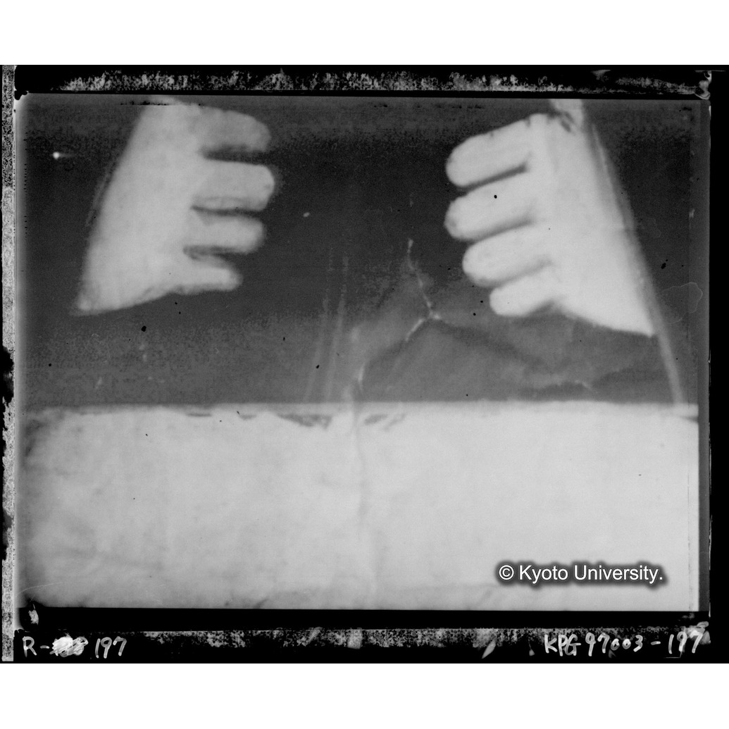 赤外線テレビ撮影画像写真（中央下段） (1)