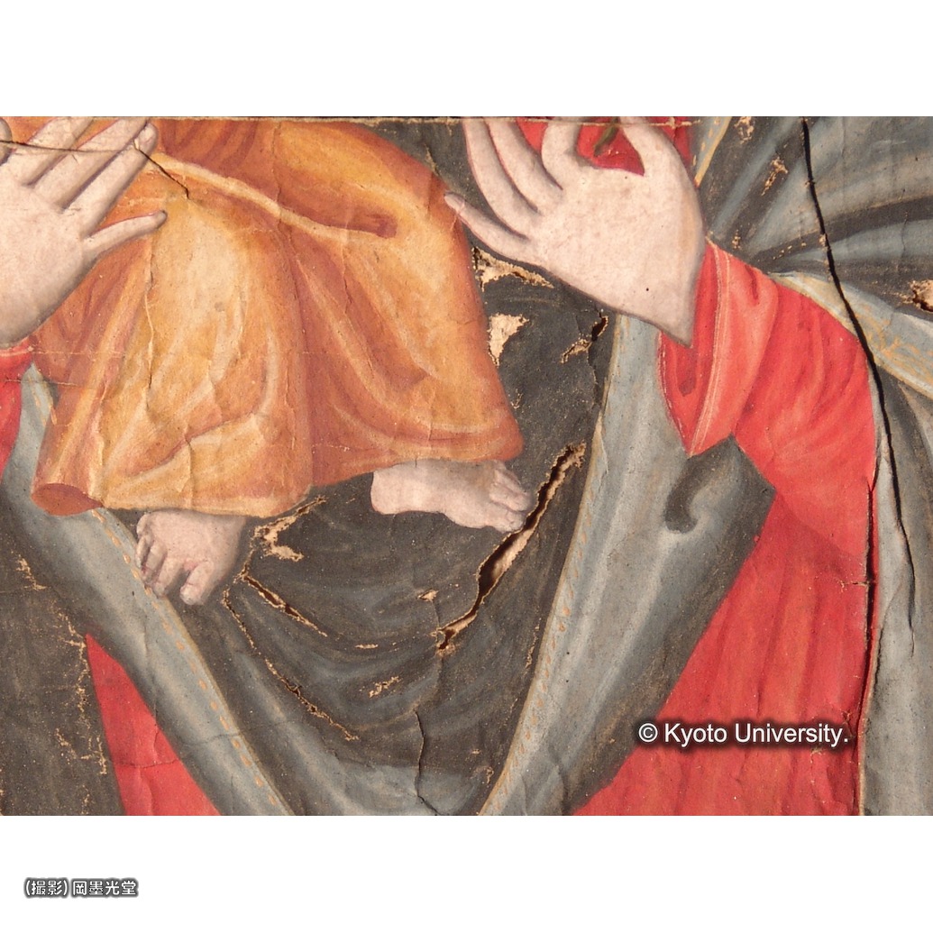 損傷（折れ・欠失） (1)