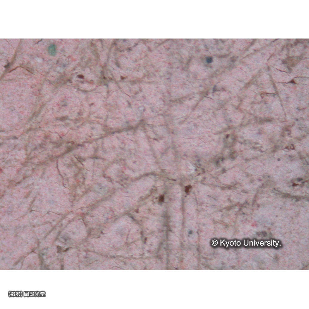 顕微鏡写真（中央上段：マリアの頬） (1)