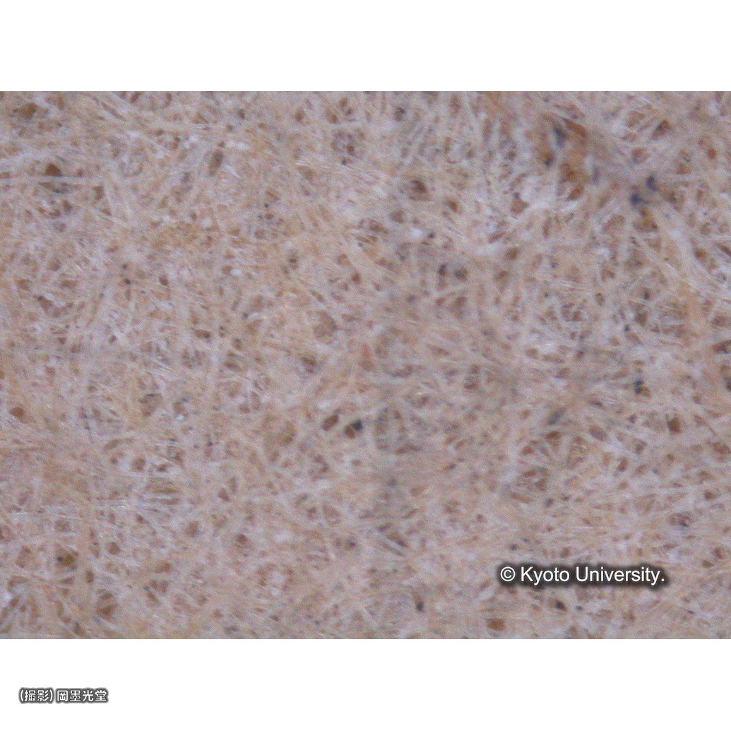 顕微鏡写真（中央上段：カーテン欠失部分） (1)