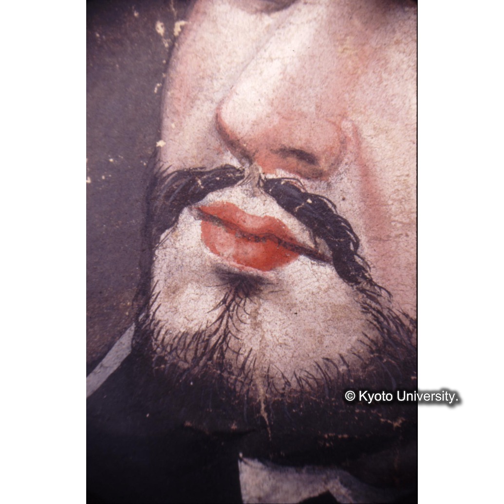 顕微鏡撮影カラー写真（中央下段：ザビエル口） (1)