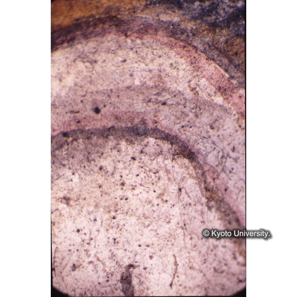 顕微鏡撮影カラー写真（十五玄義第三図：キリスト足） (1)