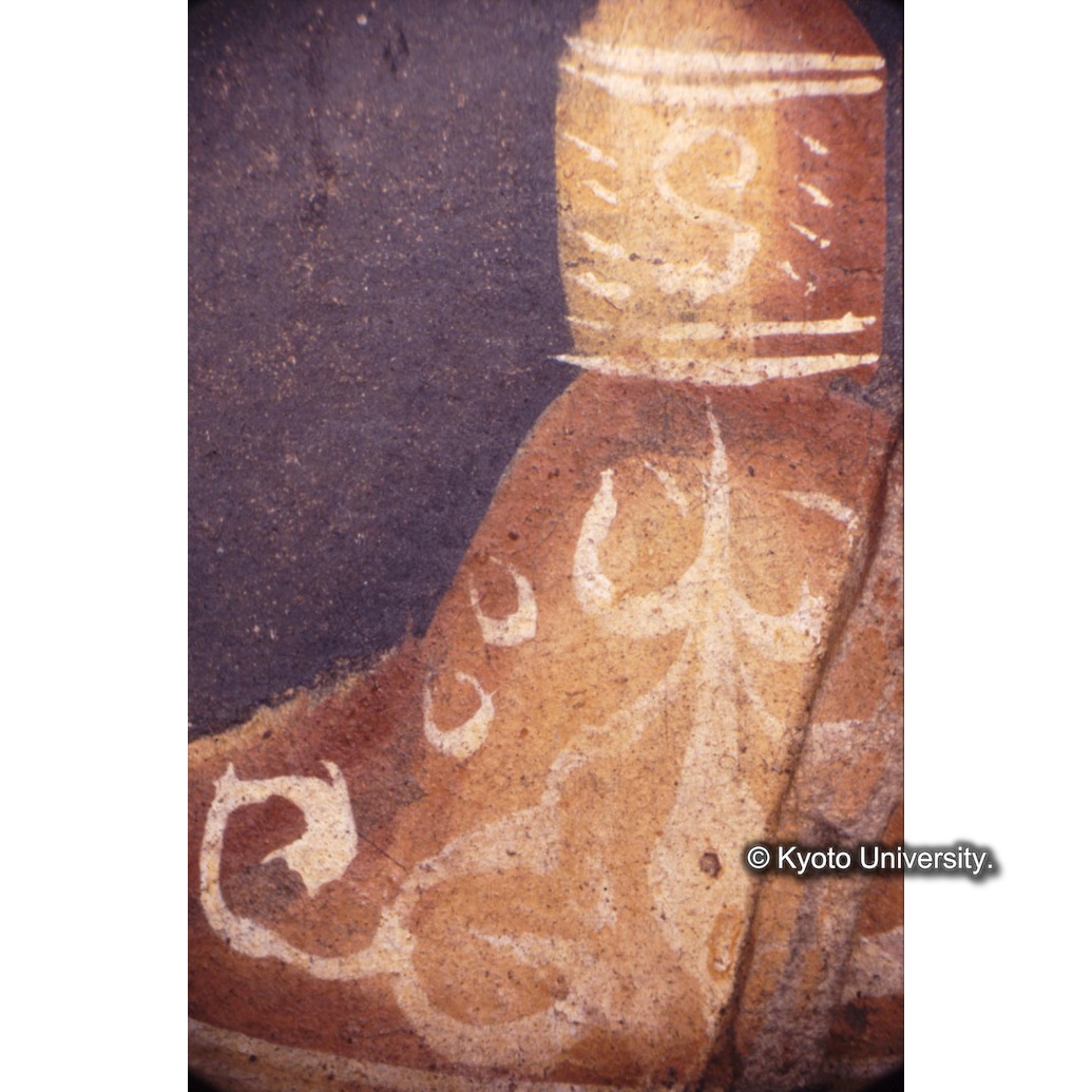 顕微鏡撮影カラー写真（中央下段：聖杯） (1)