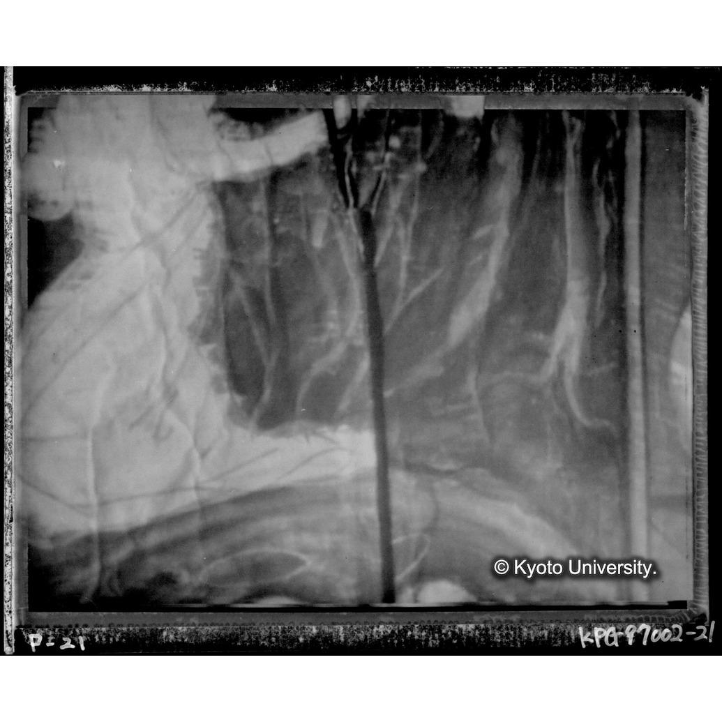 赤外線テレビ撮影画像写真（十五玄義第六図） (1)