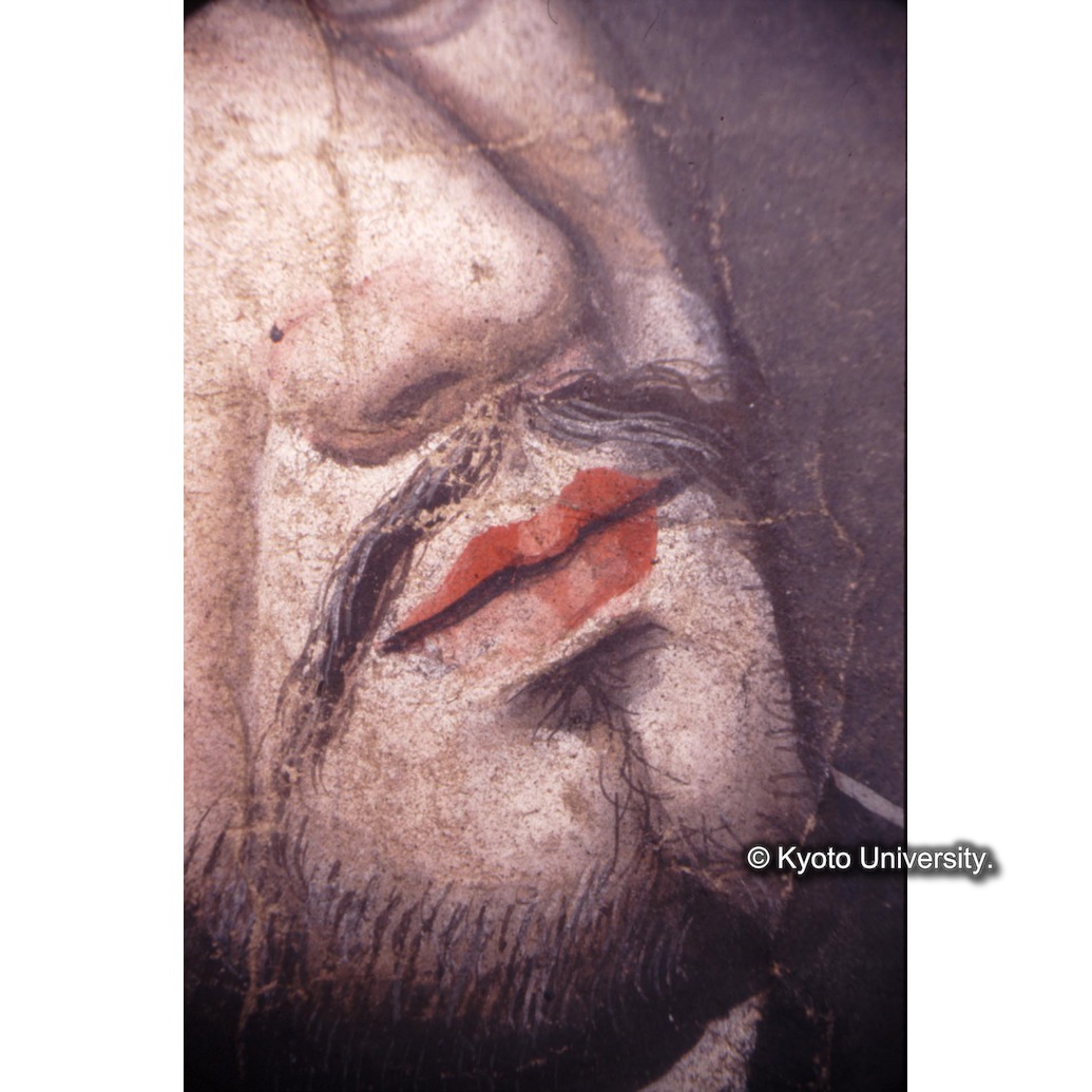 顕微鏡撮影カラー写真（中央下段：ロヨラ口） (1)