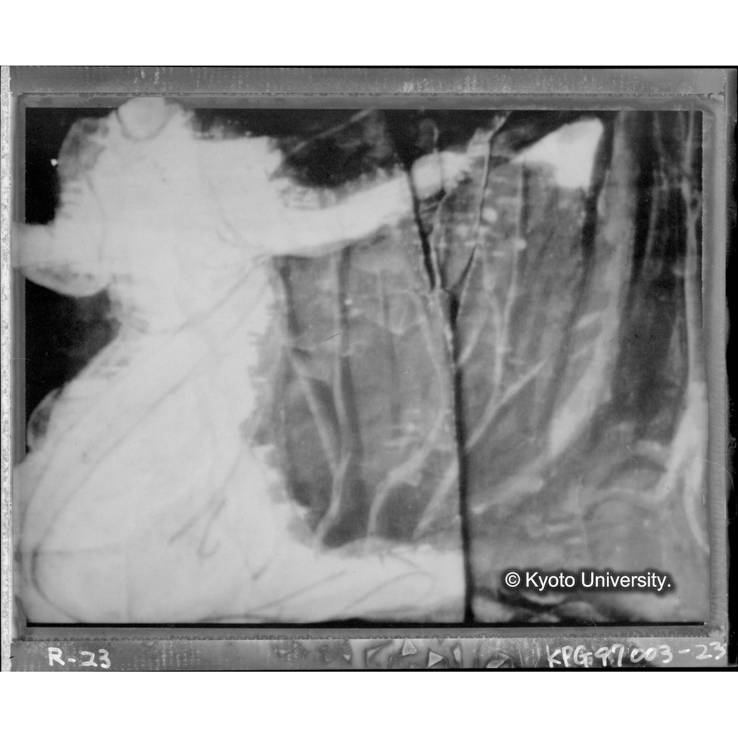 赤外線テレビ撮影画像写真（十五玄義第六図） (1)