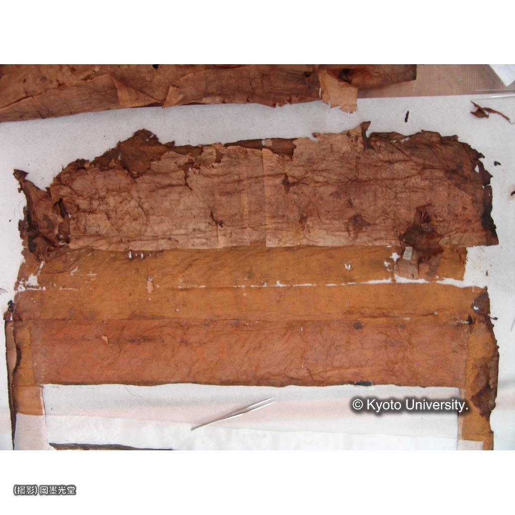 裏打ち除去（上裂） (1)