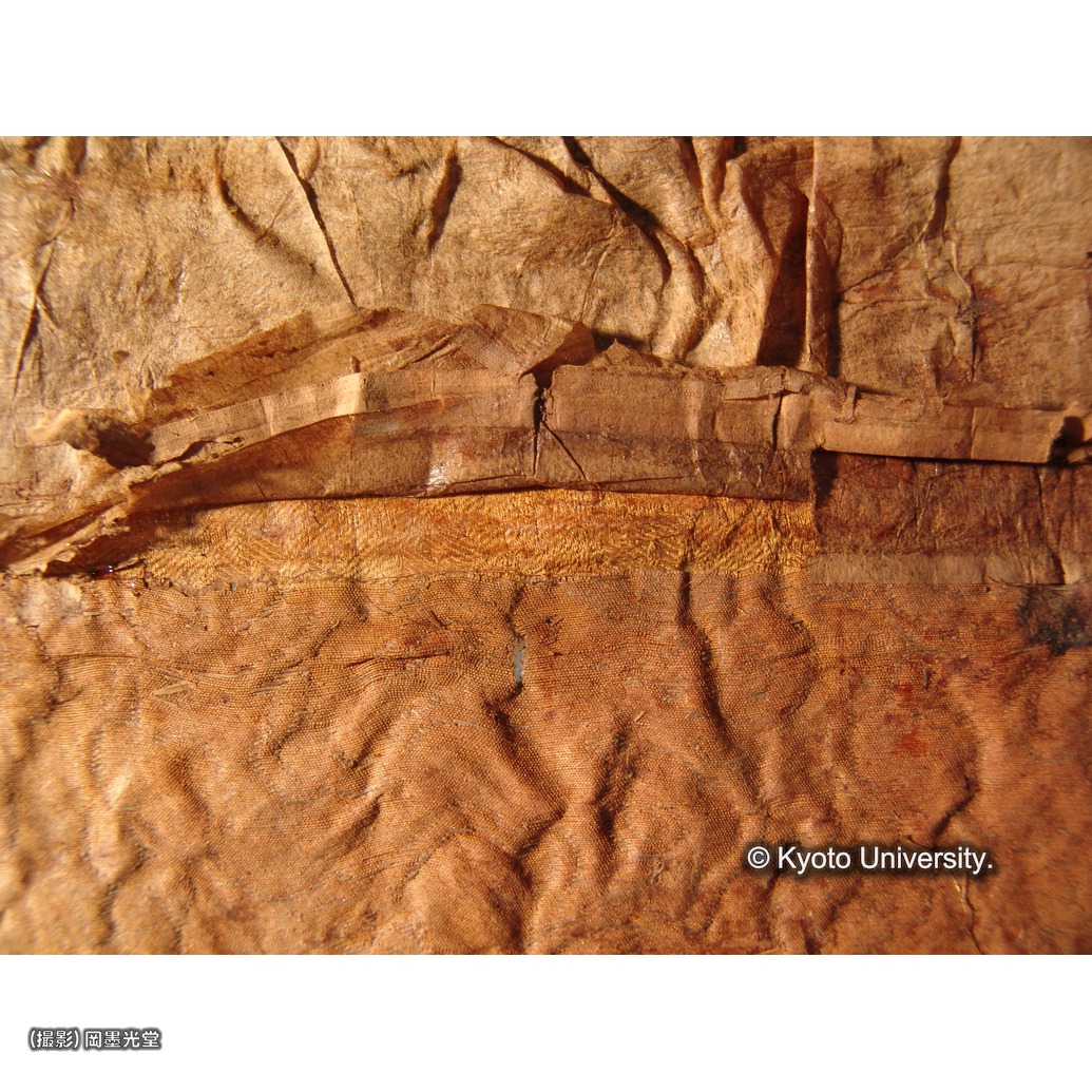 裏打ち除去（上裂） (1)