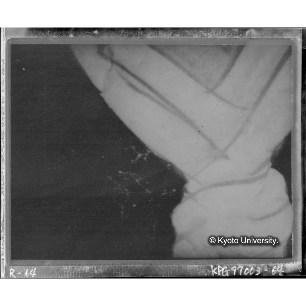 赤外線テレビ撮影画像写真（中央上段） (1)