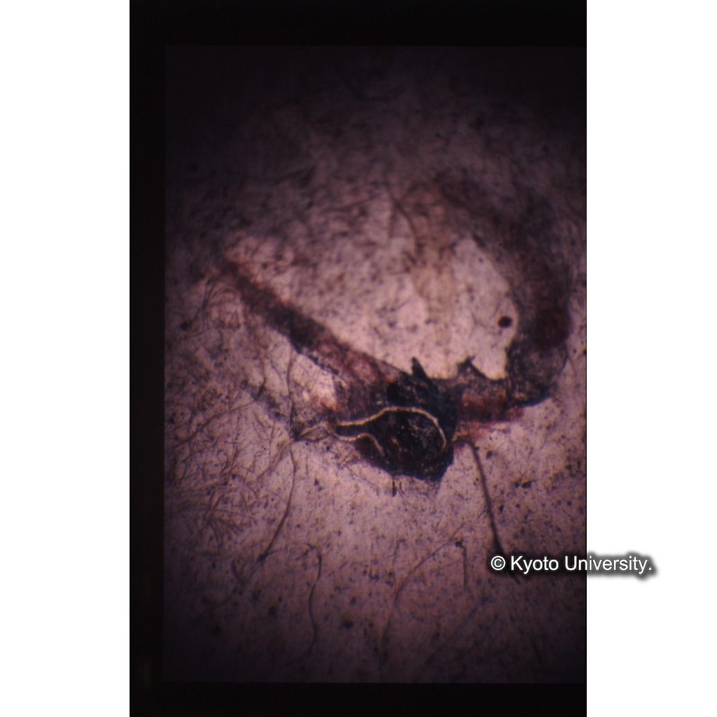 顕微鏡撮影カラー写真（十五玄義第十図：マリア目） (1)