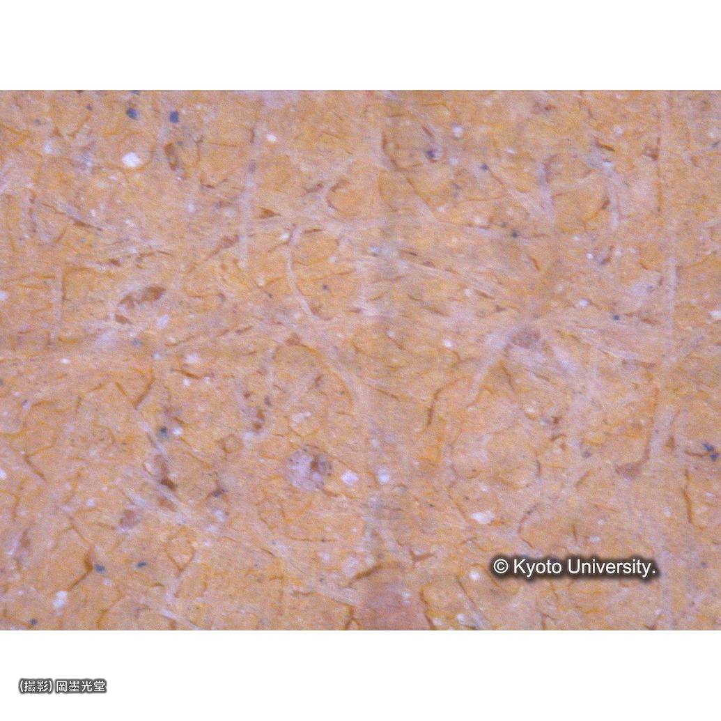 顕微鏡写真（十五玄義：第13図背景） (1)